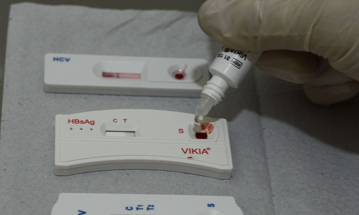 São Paulo alcança marca de 30 mil usuários cadastrados para Profilaxia Pré-Exposição ao HIV (PrEP)