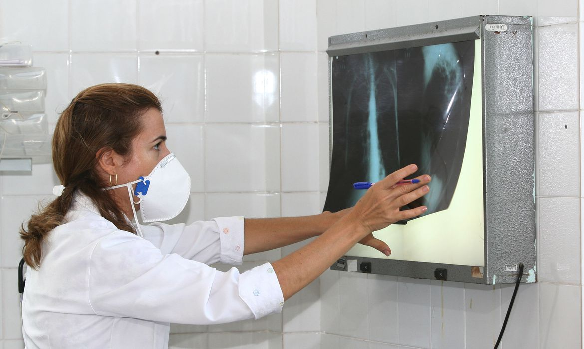 Medicamento pretomanida pode revolucionar tratamento de Tuberculose no SUS